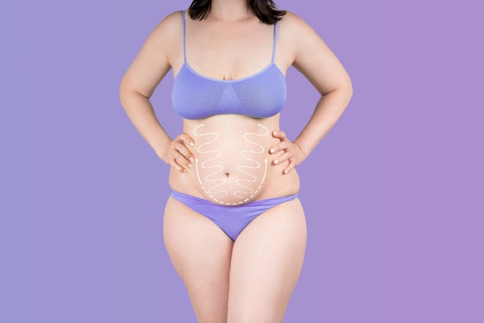 tummy tuck procedure in kuwait